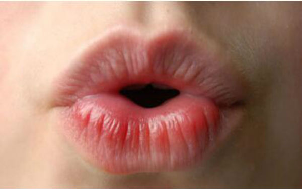 2023成都抬頭紋剝離大型醫(yī)生(董灜、周斌、劉國權(quán)當(dāng)屬當(dāng)?shù)孛麣飧?