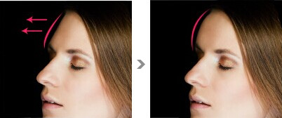 2023天津去眼部皺紋醫(yī)生推薦前10名(申銳湜、陳山偉、朱曉峰專家實(shí)力細(xì)數(shù)、價(jià)格公布)