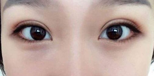 永州地區(qū)哪家正規(guī)整形醫(yī)院好？