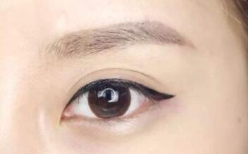 朱春艷醫(yī)師解析雙眼皮技術(shù)與手術(shù)方式，附詳細(xì)醫(yī)生介紹和診療科室信息