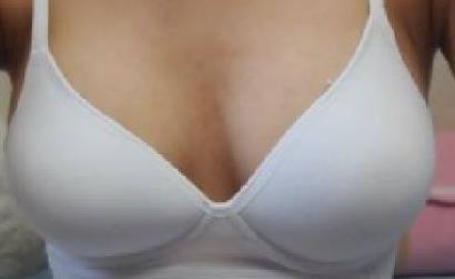 2023成都骨膠原填充下巴權威專家評價前十名(李媚、馮牧夷、葛振國綜合實力靠前！)