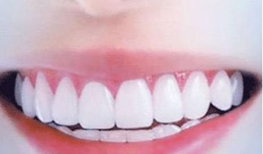 呢？衢州美萊整形美容醫(yī)院簡介、技術(shù)優(yōu)勢、口碑在線查看！