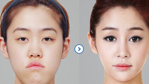 北京大學(xué)國際醫(yī)院整形外科醫(yī)生口碑如何？整形費(fèi)用合理嗎？