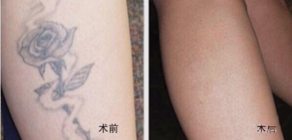 不二選擇！上海鼻修復(fù)專家徐永豐、劉仁輝搶占熱門名單成功！個(gè)人實(shí)力攀升不可阻擋！