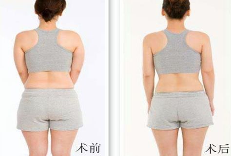 杭州哪家祛痘醫(yī)院好？綜合評測幫你選擇！