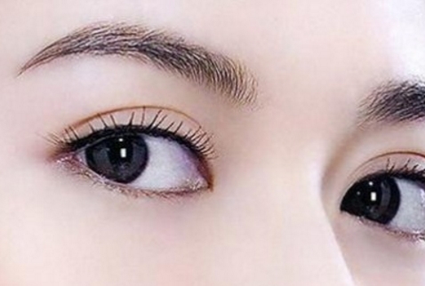 上海華美醫(yī)療美容醫(yī)院楊亞益park法雙眼皮手術(shù)效果評價