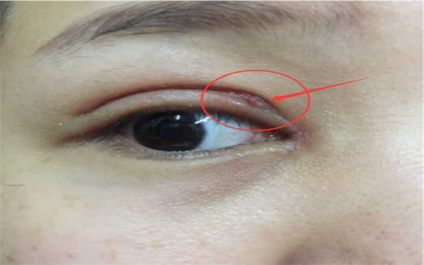 蘇州隆胸哪家醫(yī)院好？專業(yè)醫(yī)師為您分析