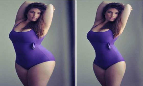 沈陽哪家醫(yī)院割雙眼皮效果好，推薦2023年最受歡迎的醫(yī)院