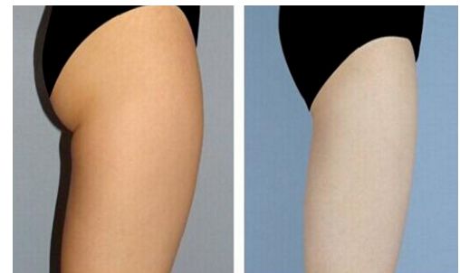 烏魯木齊超聲刀哪家好？烏魯木齊超聲刀醫(yī)院排名及專家推薦