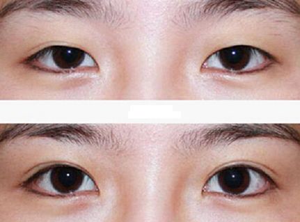 廣州整容鼻子技術排名前列的醫(yī)院有哪些？