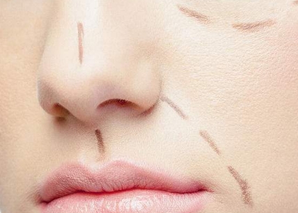 2023成都點(diǎn)陣射頻祛眼紋專家榜單前十(蘇偉、汪國(guó)義、鄧朝東坐診陣容強(qiáng))