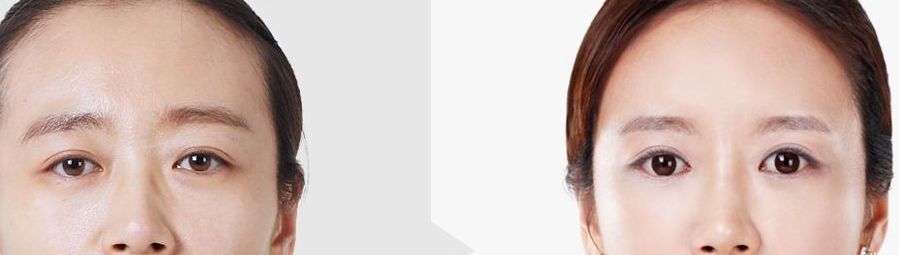 昆明祛疤醫(yī)院哪家好，正規(guī)機構推薦