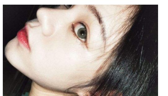 找一家靠譜的汕頭去除疤痕醫(yī)院？看這里！