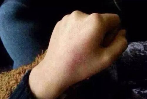 2023南京注射除細紋排名十強醫(yī)生(吳國平、亓發(fā)芝、張廣宇技術(shù)很權(quán)威)