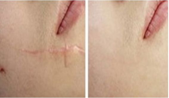 成都整容醫(yī)院哪家更專業(yè)靠譜？哪家整容醫(yī)院口碑好？