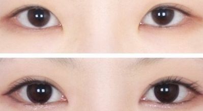 西安王者風(fēng)范嫩膚哪家好？一文讀懂西安嫩膚機(jī)構(gòu)排行榜