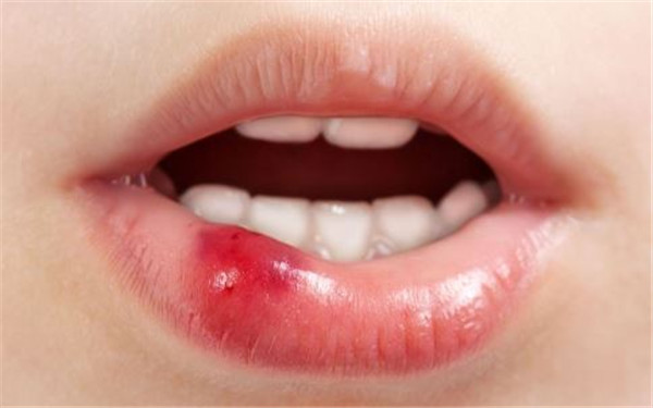 2023青島美鼻排行top10強專家(安波、邱明昕、曾高綜合實力強不強？)