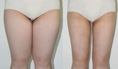 西安北郊美容整形哪家好？揭秘西安北郊最受歡迎的美容整形機(jī)構(gòu)排名