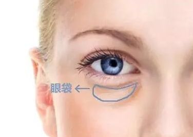 蘇州哪家醫(yī)院治療黃褐斑效果好？