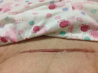 2023廈門胳膊吸脂專家排行榜前10(李強(qiáng)、劉培林、閆保程熱門醫(yī)生簡介發(fā)布)