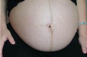 上海哪里有鼻修復(fù)專家？選擇困難癥仙女來了，點(diǎn)擊查看醫(yī)生介紹和價(jià)格！