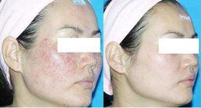 揭陽市哪家醫(yī)院的美容整形技術(shù)最好？