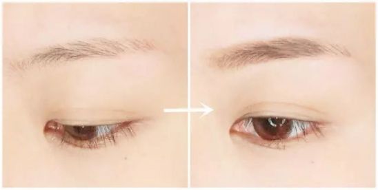 2023贛州自體脂肪注射印第安紋在榜名單前10位醫(yī)生(汪洋、熊德成、嚴健頻正規(guī)專家包你滿意)