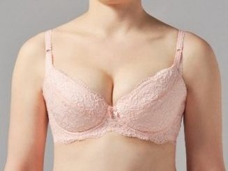 西京醫(yī)院雙眼皮修復(fù)值得選擇嗎？