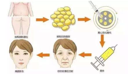 長沙鼻修復醫(yī)生推薦！多位專家實力PK，功力高出你的期待！最適合急需求的技術實力誰更強？