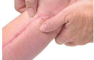 廣州哪家美容醫(yī)院好？詳細(xì)比較廣州頂級醫(yī)療機(jī)構(gòu)個美容醫(yī)院的優(yōu)缺點(diǎn)