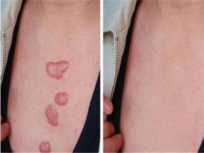 云南哪家整形醫(yī)院好？找個(gè)專業(yè)的才放心！