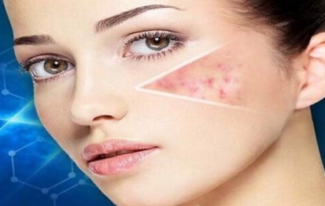 昆明祛痘效果最好的美容醫(yī)院推薦！