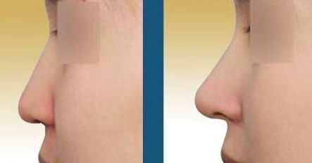 西安哪家皮膚美容機(jī)構(gòu)做得好？