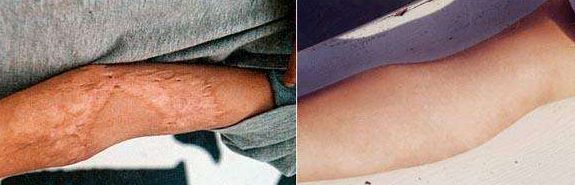 北京下顎骨手術(shù)哪家好？全面解析北京市優(yōu)質(zhì)下顎骨手術(shù)醫(yī)院及醫(yī)生推薦