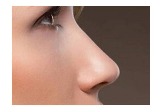 昆明狐臭求治，哪家醫(yī)院治療效果好？