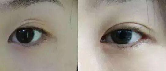 南京哪家假體豐胸醫(yī)院好？醫(yī)術(shù)精湛、效果明顯的南京豐胸?？漆t(yī)院推薦