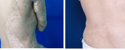 上海隆鼻哪家整形醫(yī)院好？權(quán)威醫(yī)生為您推薦的上海隆鼻醫(yī)院排行榜