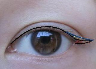 2023昆明隆胸整形哪家醫(yī)院好？專家推薦與真實案例一覽