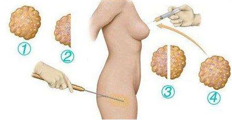 上海市排名靠前的專業(yè)祛疤痕醫(yī)院有哪些？