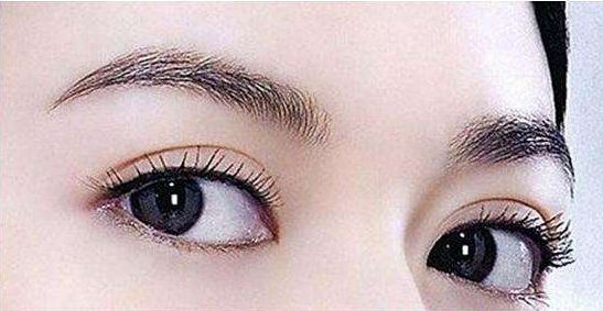 哪家成都醫(yī)院最適合取肉痣？專業(yè)醫(yī)療機(jī)構(gòu)推薦