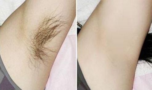 成都M唇做的好的醫(yī)院有哪些？