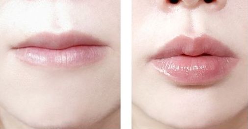 南京哪家醫(yī)院治療黃褐斑效果好？