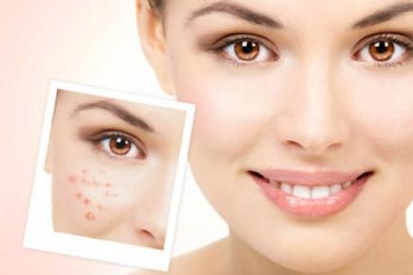 蘇州治療痘痘最好的醫(yī)院有哪些？