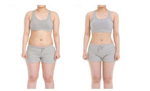 上海哪家醫(yī)院能有效去除妊娠紋，讓肌膚重新恢復(fù)緊致？