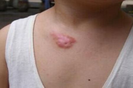 上海切眼袋手術(shù)醫(yī)院排名及口碑如何？