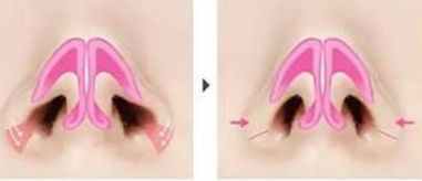 荊州美傲整形醫(yī)院門診有哪些擅長的項目？