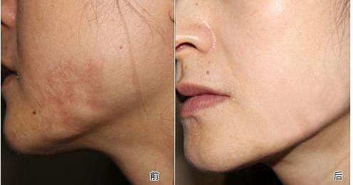 山東哪家整形醫(yī)院口碑好且專業(yè)？