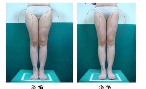 杭州做埋線(xiàn)哪家醫(yī)院好？選擇正規(guī)專(zhuān)業(yè)的醫(yī)療機(jī)構(gòu)，安全可靠！