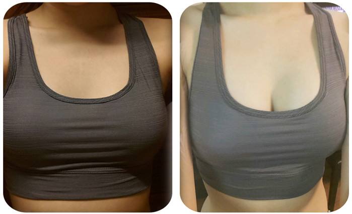 2023上海剝離細(xì)紋權(quán)威專家榜單TOP10強(qiáng)(丁偉、錢成寶、張杰醫(yī)美技術(shù)到位)