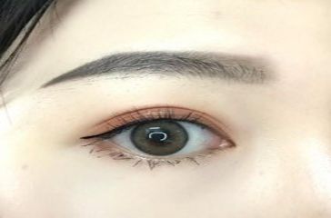 上海去黑眼圈哪個醫(yī)院好？專家推薦的實力醫(yī)院排行榜